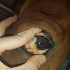 Babesiosis